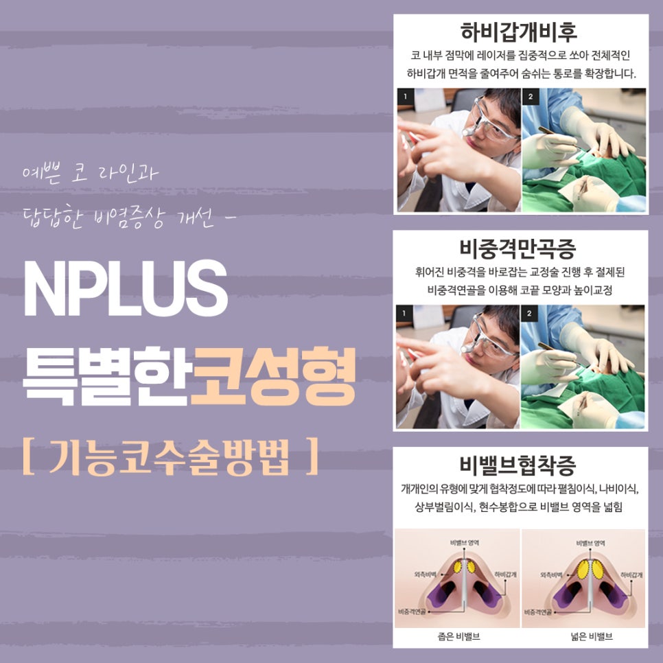 A Nose Surgery Review That Accurately Checks Function Too image 10