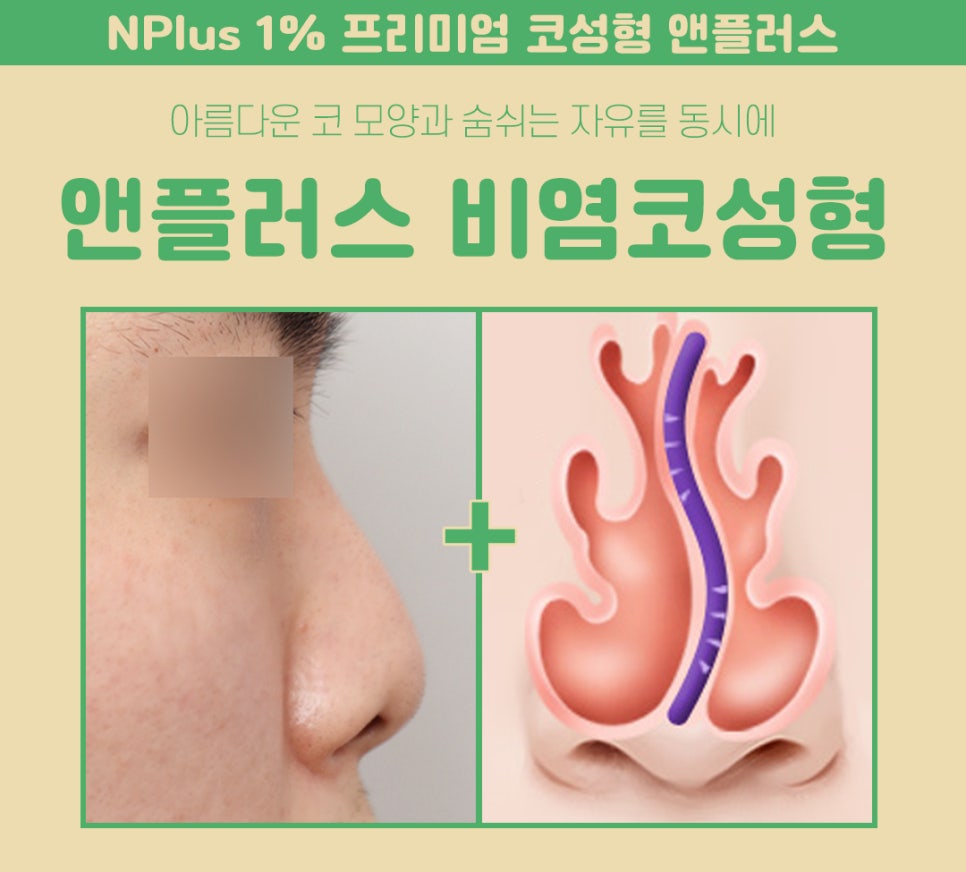 비염수술코성형 동시에 개선이 가능 관련 이미지 3