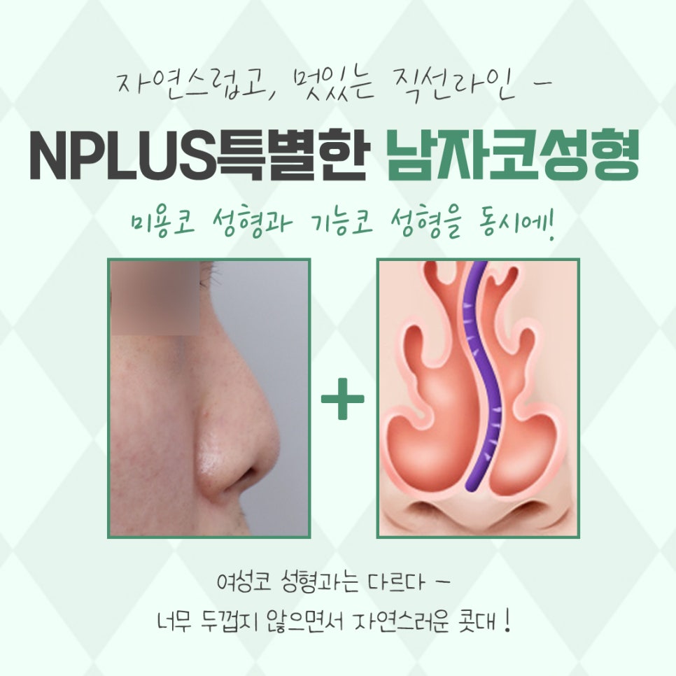 남자성형 잘 판단하고 결정 관련 이미지 3
