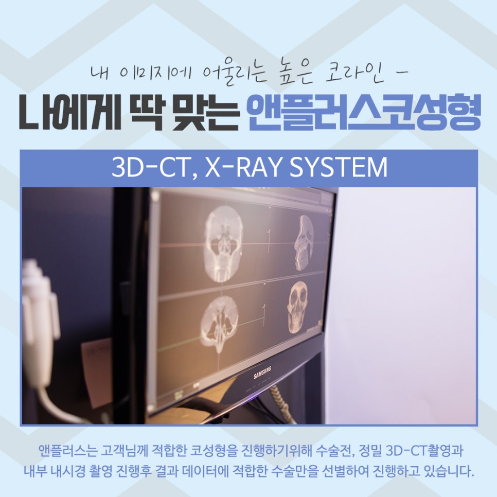 The Importance of Choosing Apgujeong Rhinoplasty image 7