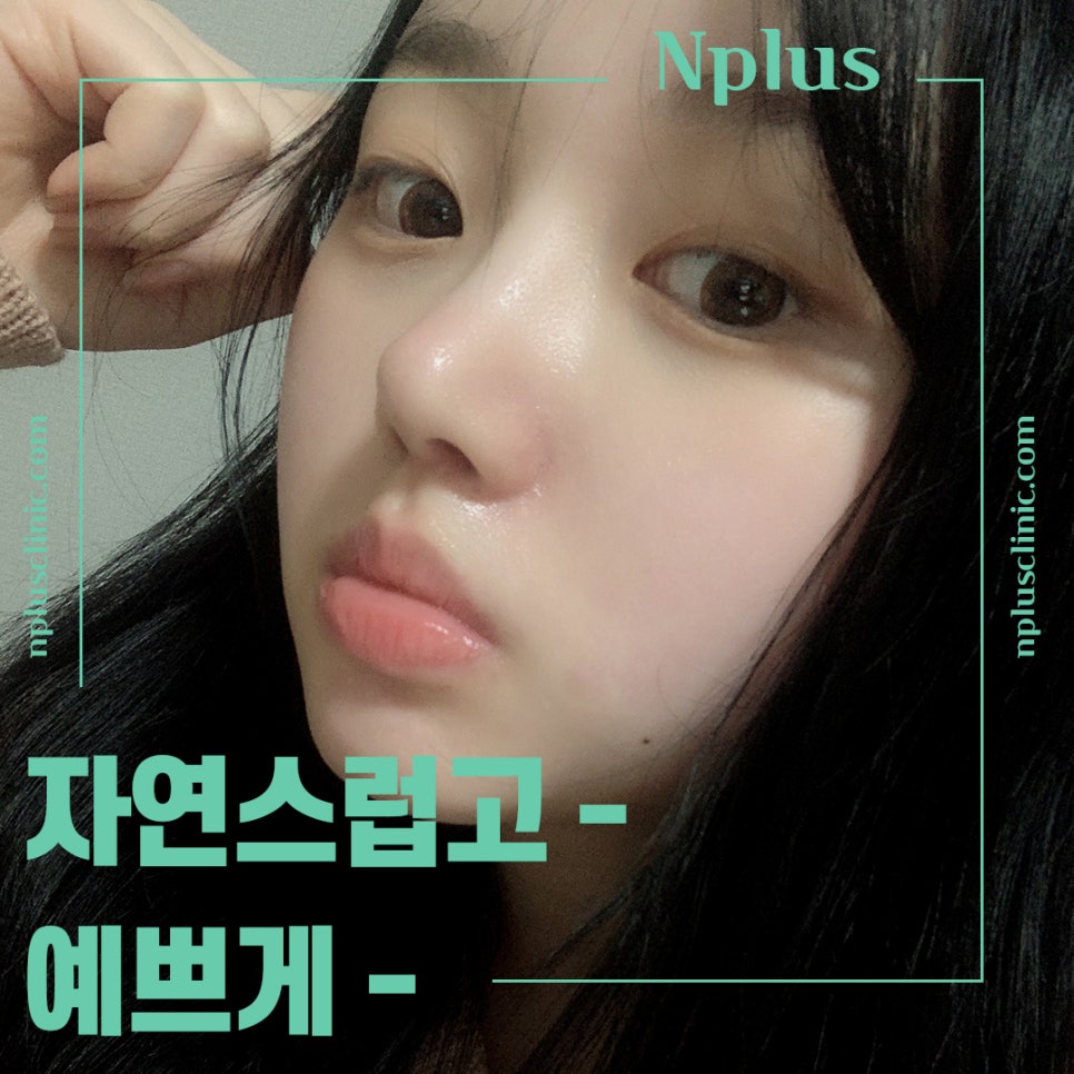코성형후기 자연스러운 코라인으로 관련 이미지 13
