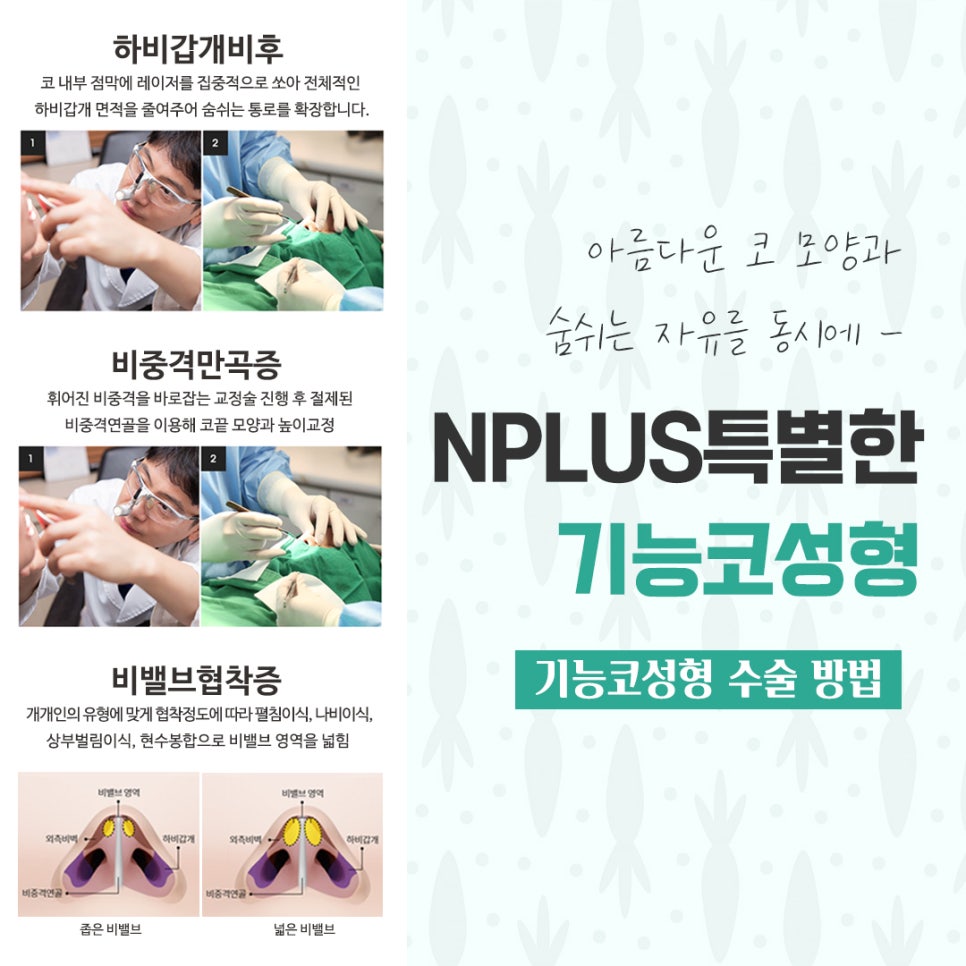 기능코수술후기 다양하게 고려하여 관련 이미지 9