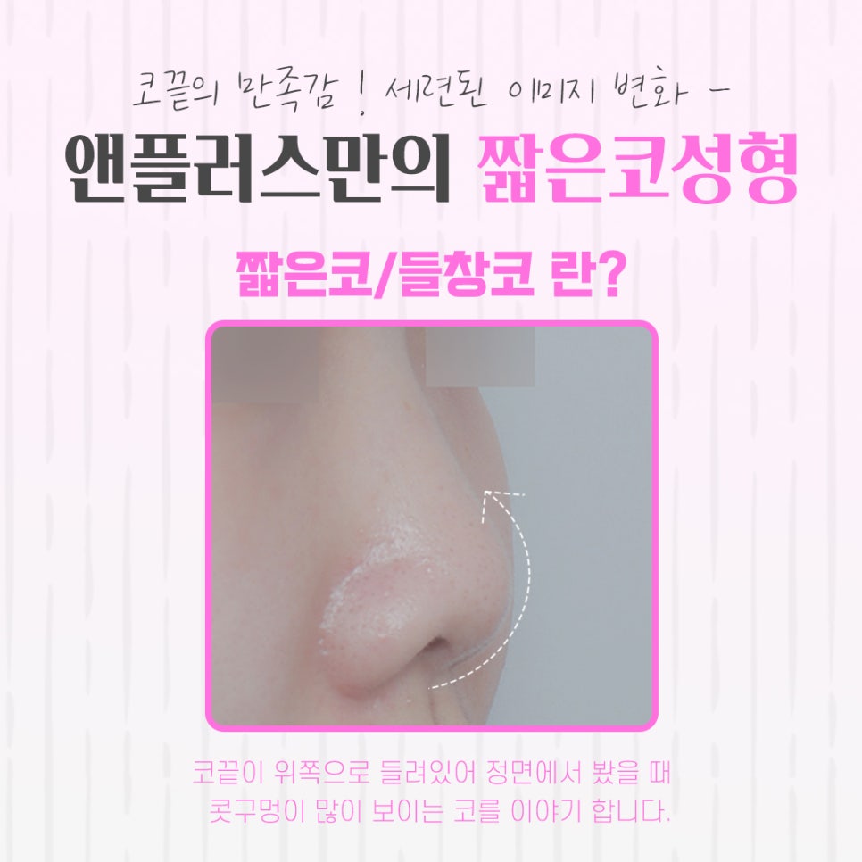 짧은코성형 정보를 정확하게 찾아보고 관련 이미지 4