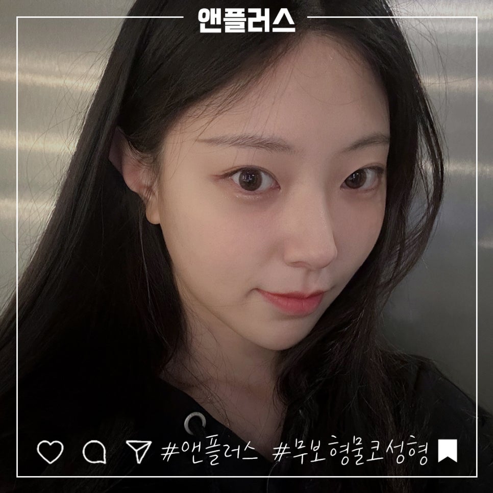 무보형물코성형후기 만족스러운 라인으로 관련 이미지 1