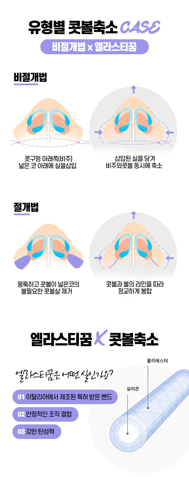 앤플러스에서 진행하는 콧볼축소 이벤트! 관련 이미지 4