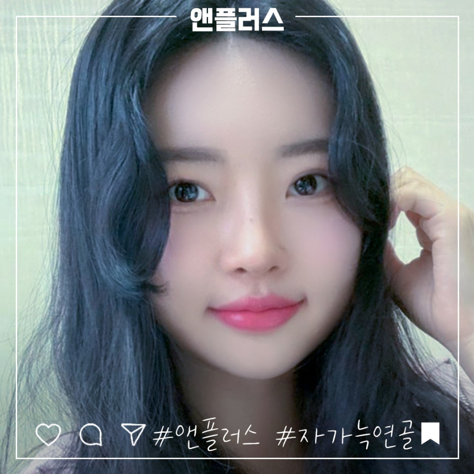 자가늑연골코수술로 처음부터 확실하게 관련 이미지 1