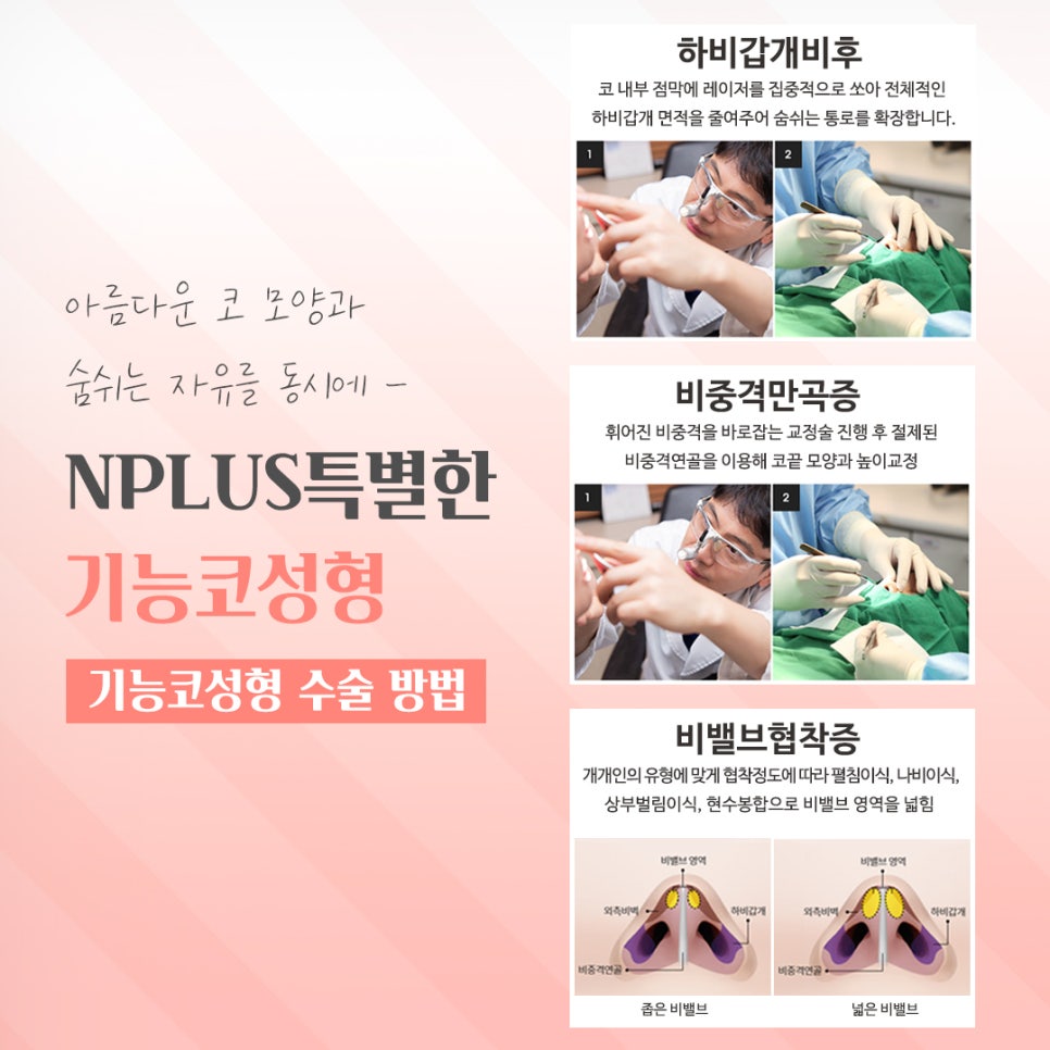기능코성형전후를 찾아보고 관련 이미지 9