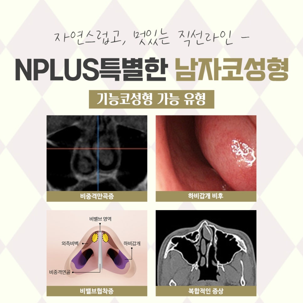 Male Nose Surgery Review: If You Want an Improved Appearance image 6