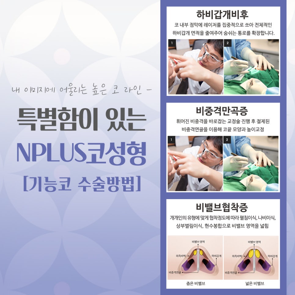 코수술잘하는곳에 대해 꼼꼼하게 체크하여 관련 이미지 9