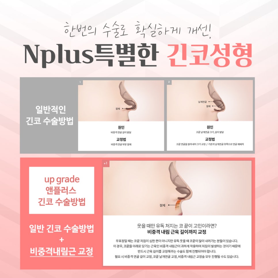 Learn More About Long Nose Surgery in Detail image 6