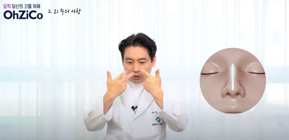 앤플러스에서 전달드리는 코성형주의사항 관련 이미지 14