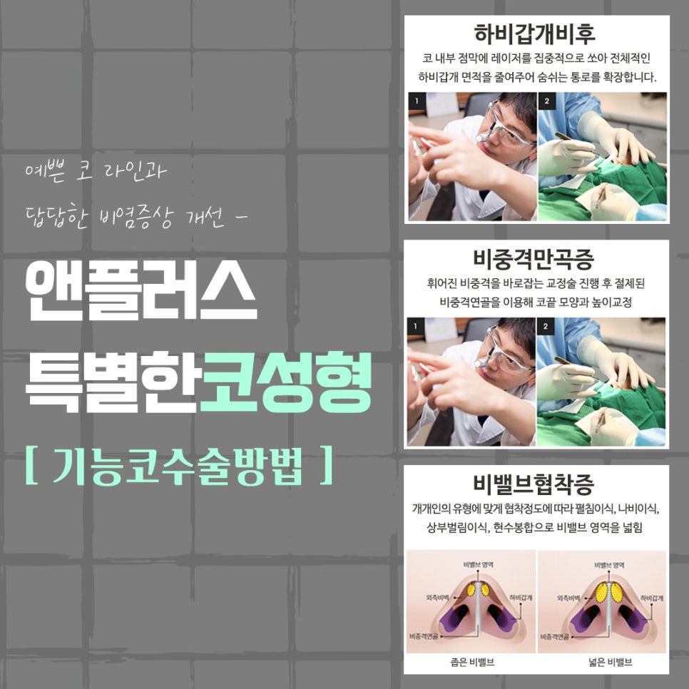 강남코수술후기 확실하게 알아보고 관련 이미지 11
