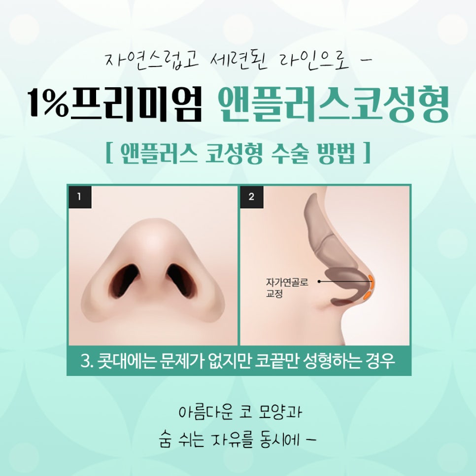 늑연골코성형에 대해 자세히 알아보고 관련 이미지 10