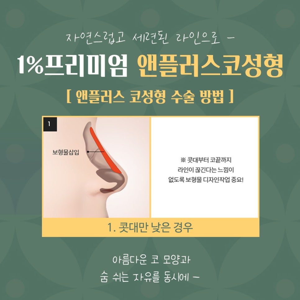 자가늑코성형 후기까지 확인하고 관련 이미지 8