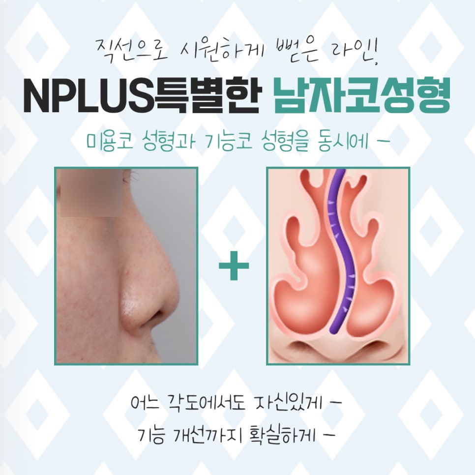 Learn More About Before and After Male Nose Surgery in Detail image 8