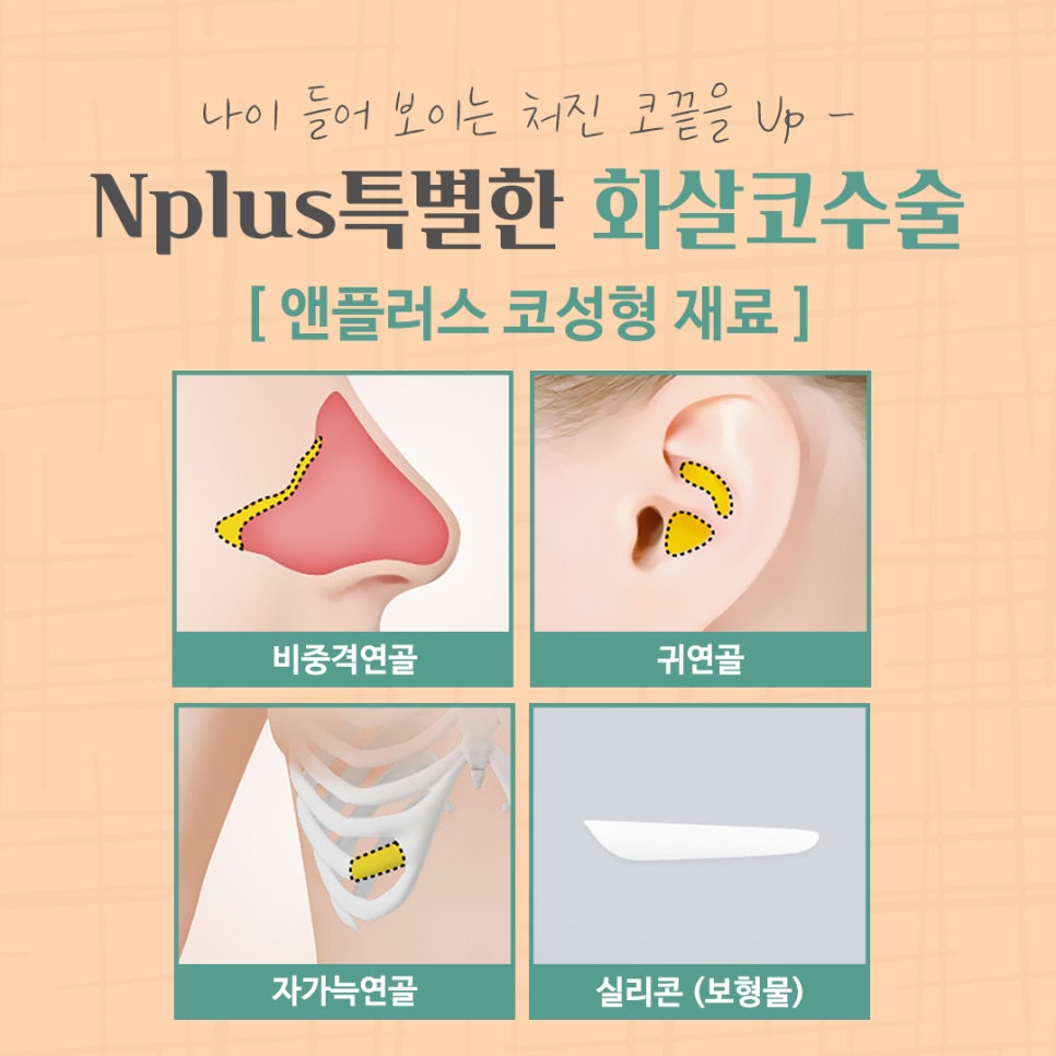 화살코수술 후기까지 알아보고 결정 관련 이미지 12