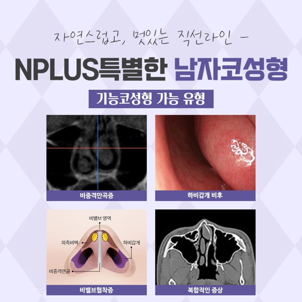 남자코성형후기 내부까지 확인하여 관련 이미지 5