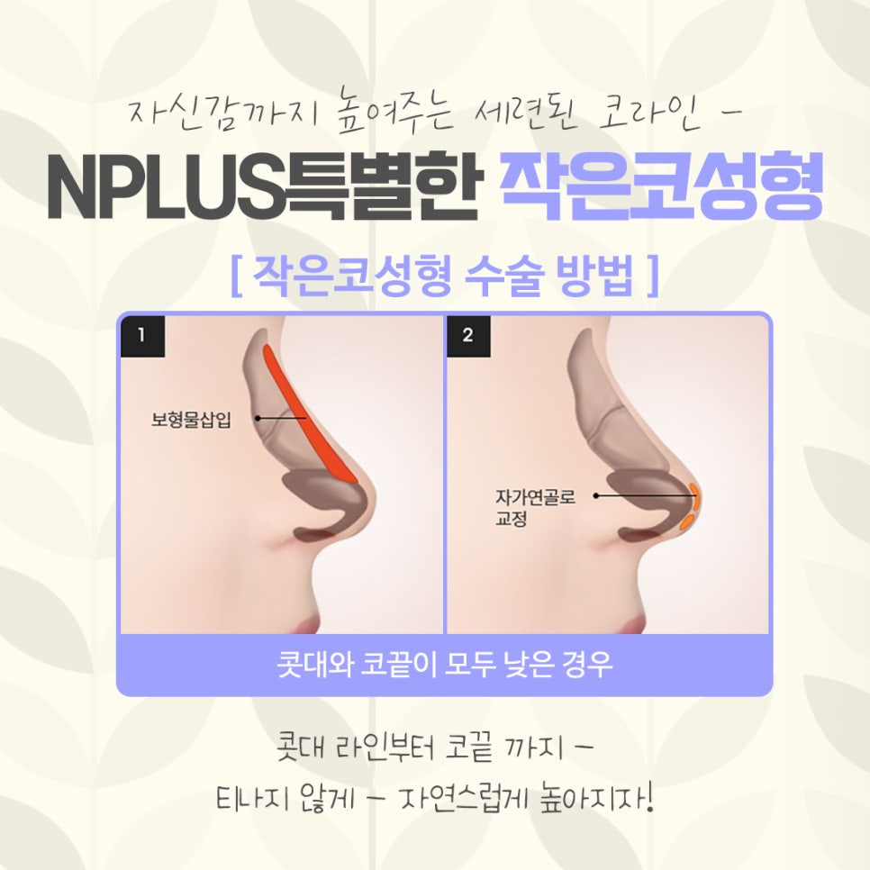 작은코성형에 대해 자세하게 확인하고 관련 이미지 7