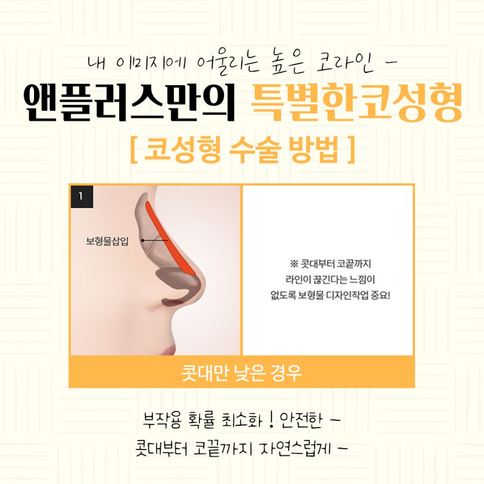 Autologous Cartilage Rhinoplasty for a Natural Nose Line image 9