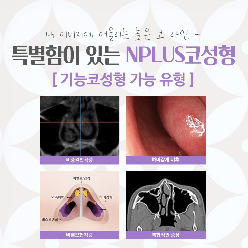 코수술잘하는곳 자세하게 알아보고 관련 이미지 5