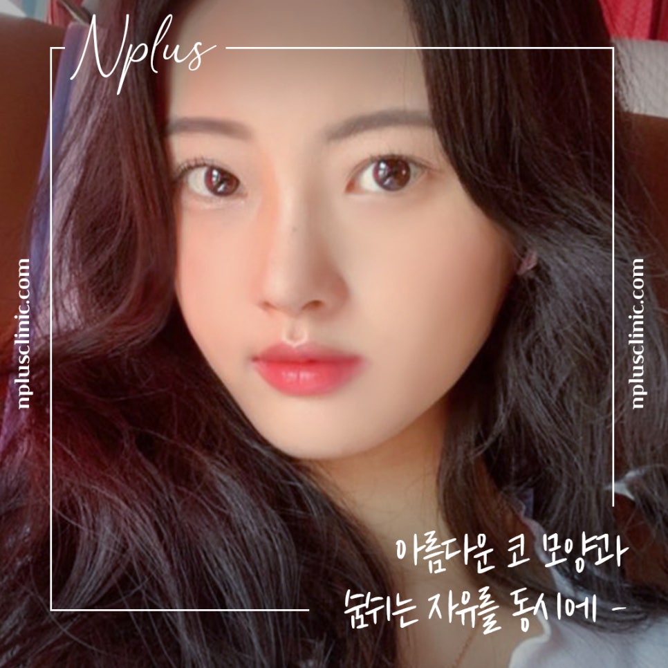 코성형 후기로 알아보고 결정 관련 이미지 3