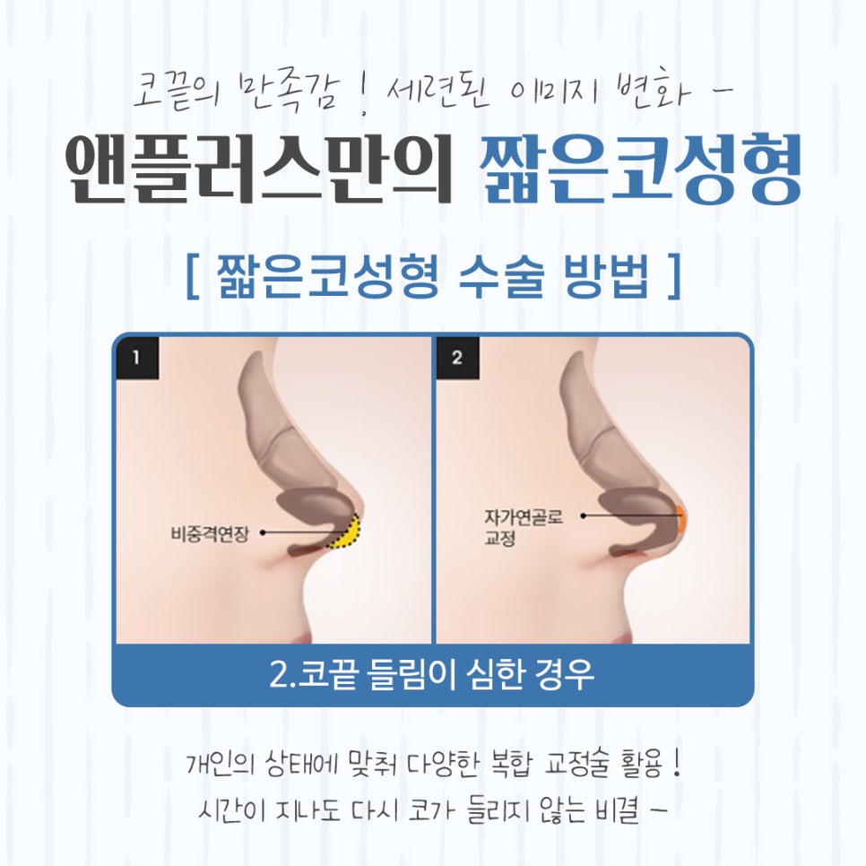 A Beautiful Nose Line with Short Nose Surgery image 9
