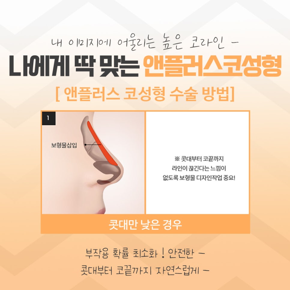 코수술후기에 대해 자세히 찾아보고 관련 이미지 9