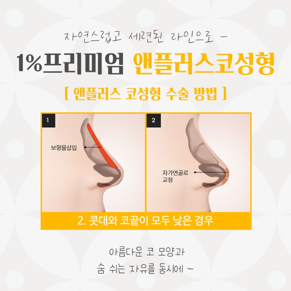 자가늑연골코성형의 필요성 관련 이미지 9