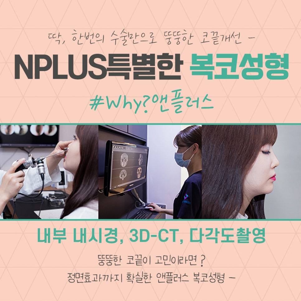 복코성형후기 코지방제거로 확실하게 관련 이미지 5
