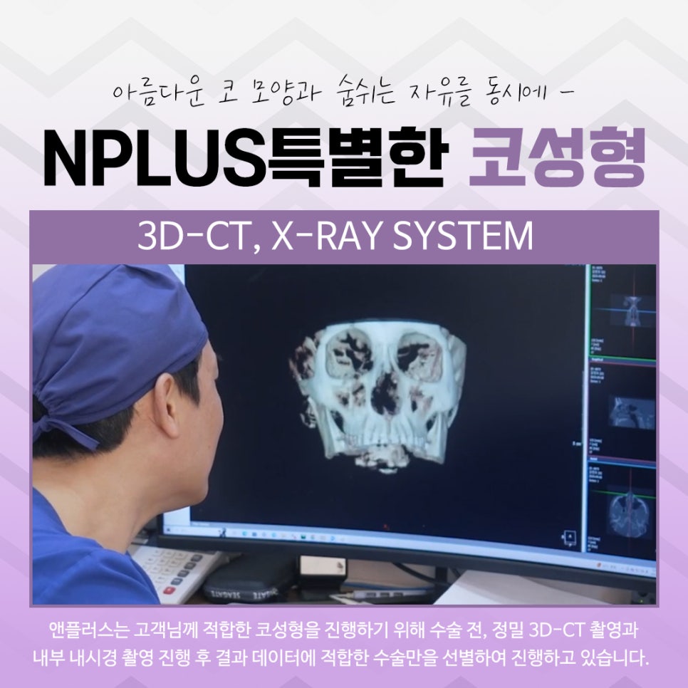 코수술전후 자연스러운 라인으로 관련 이미지 7