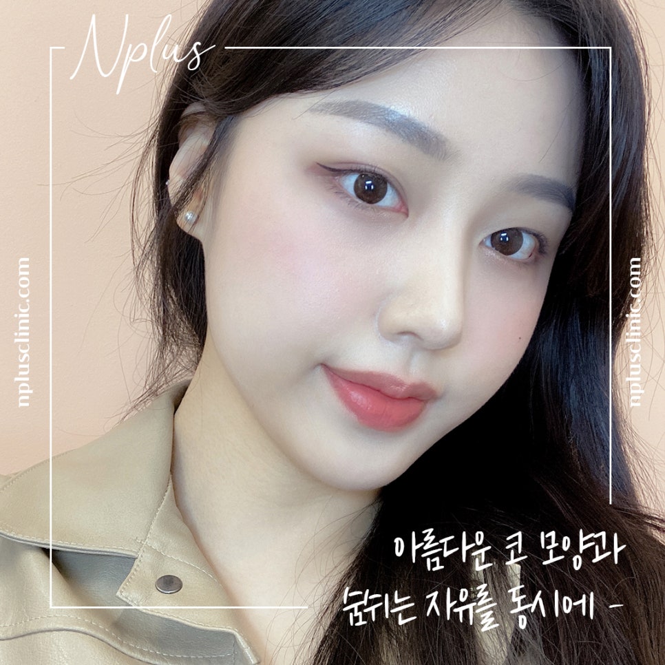 콧볼축소수술후기 내게 어울리는 라인으로 관련 이미지 1