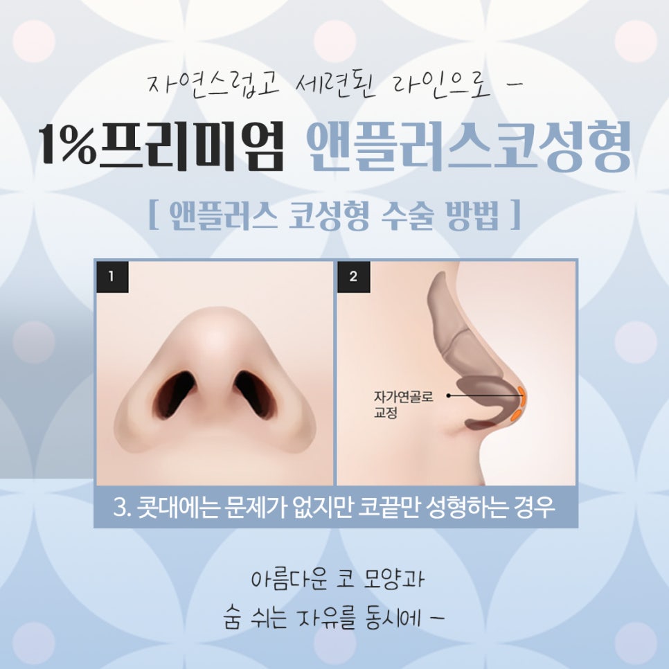 Reviewing and Deciding on Self-Rib Nose Surgery Reviews image 9