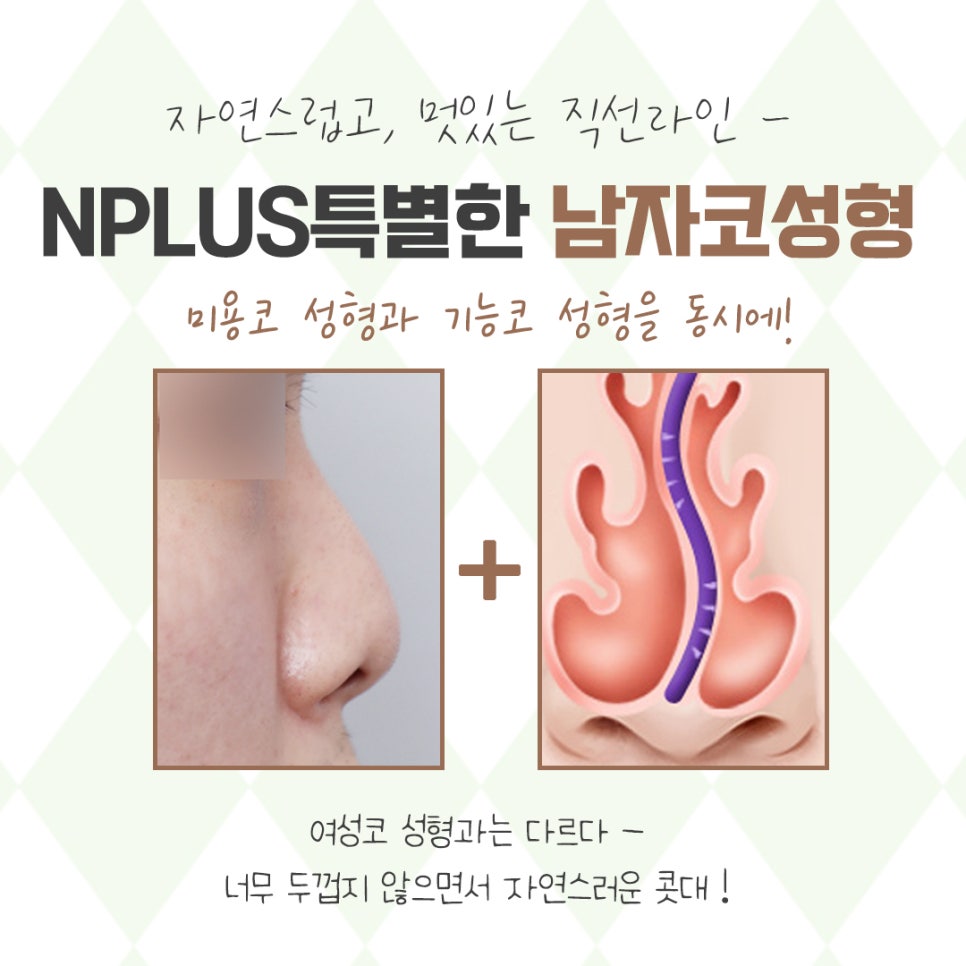 남자코성형후기를 확인하고 이미지 개선 관련 이미지 4