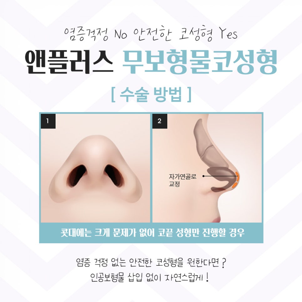 무보형물코성형후기 자연스러운 이미지로 관련 이미지 7