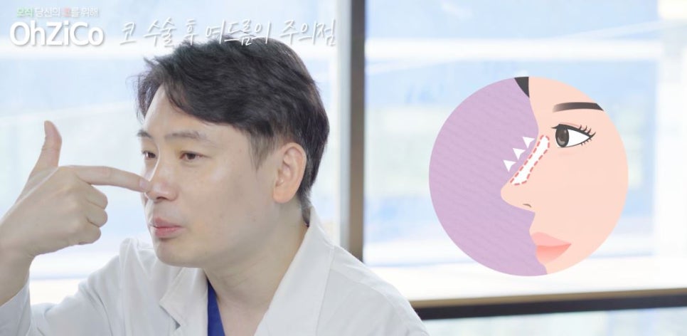 코수술후 코여드름 원인과 해결 방법 관련 이미지 11