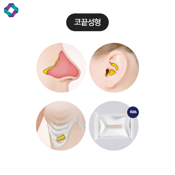 코수술 전후 비교, 앤플러스 매부리코에 대하여 관련 이미지 5