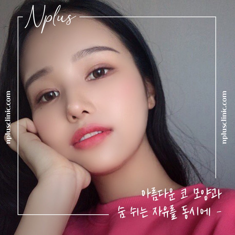 자가늑연골코성형으로 세련된 이미지로 변신 관련 이미지 5