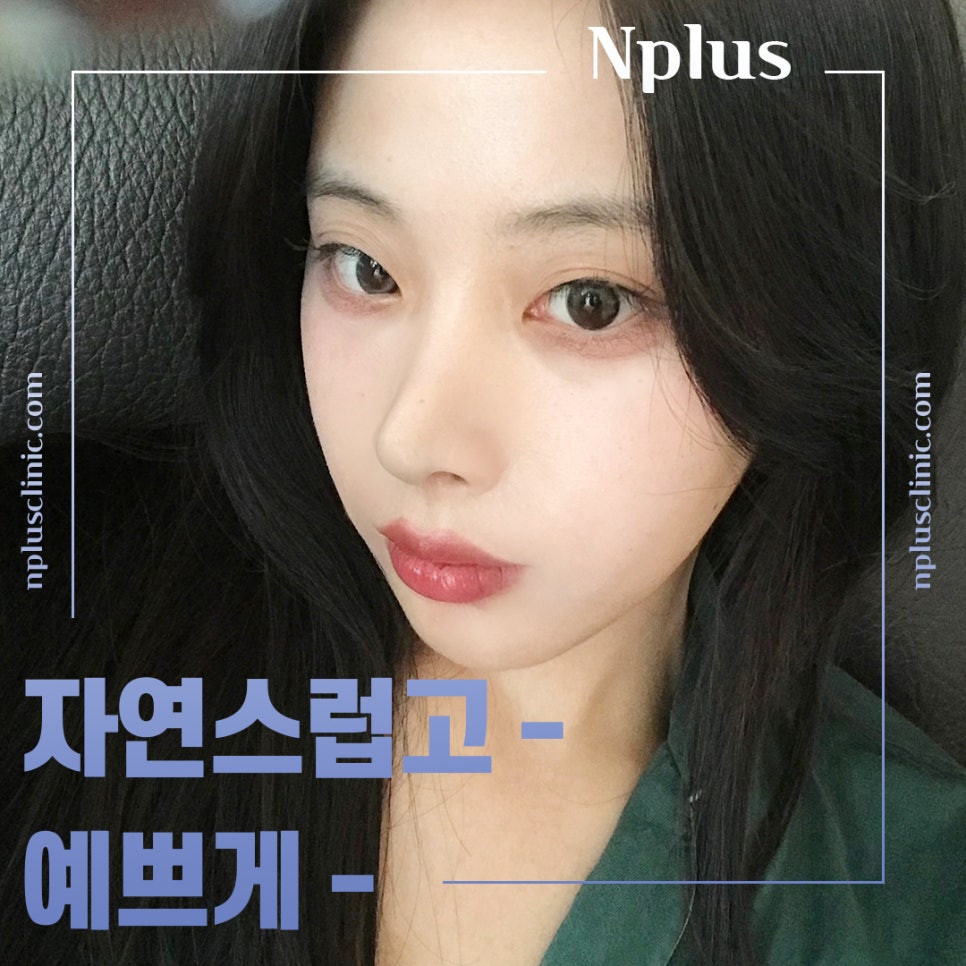 압구정코성형에서 자연스럽게 개선 관련 이미지 11