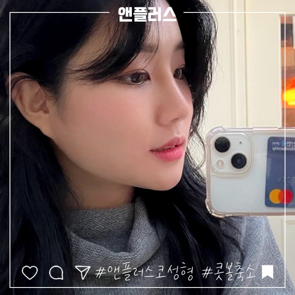 Choosing After Checking Rhinoplasty Alar Reduction Surgery Reviews image 1