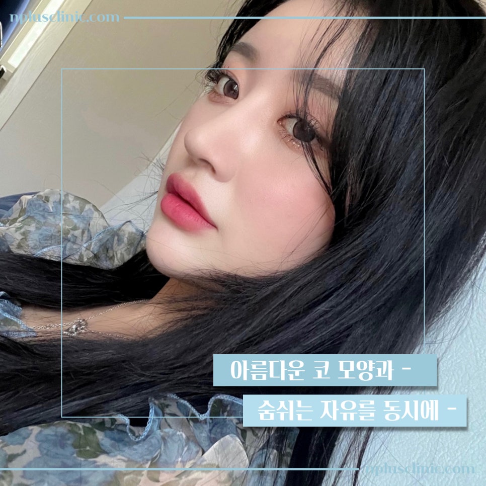 기능코성형비용을 다양하게 알아보고 관련 이미지 2