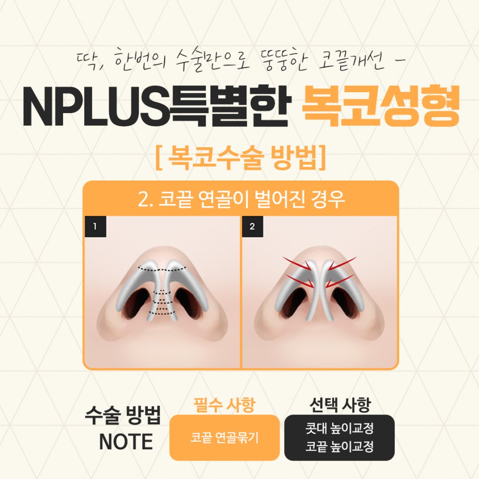 복코수술후기 정확한 진단을 통하여 관련 이미지 9