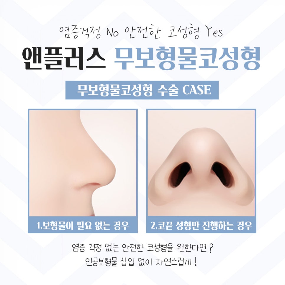 Detailed Information on Non-Implant Rhinoplasty image 7