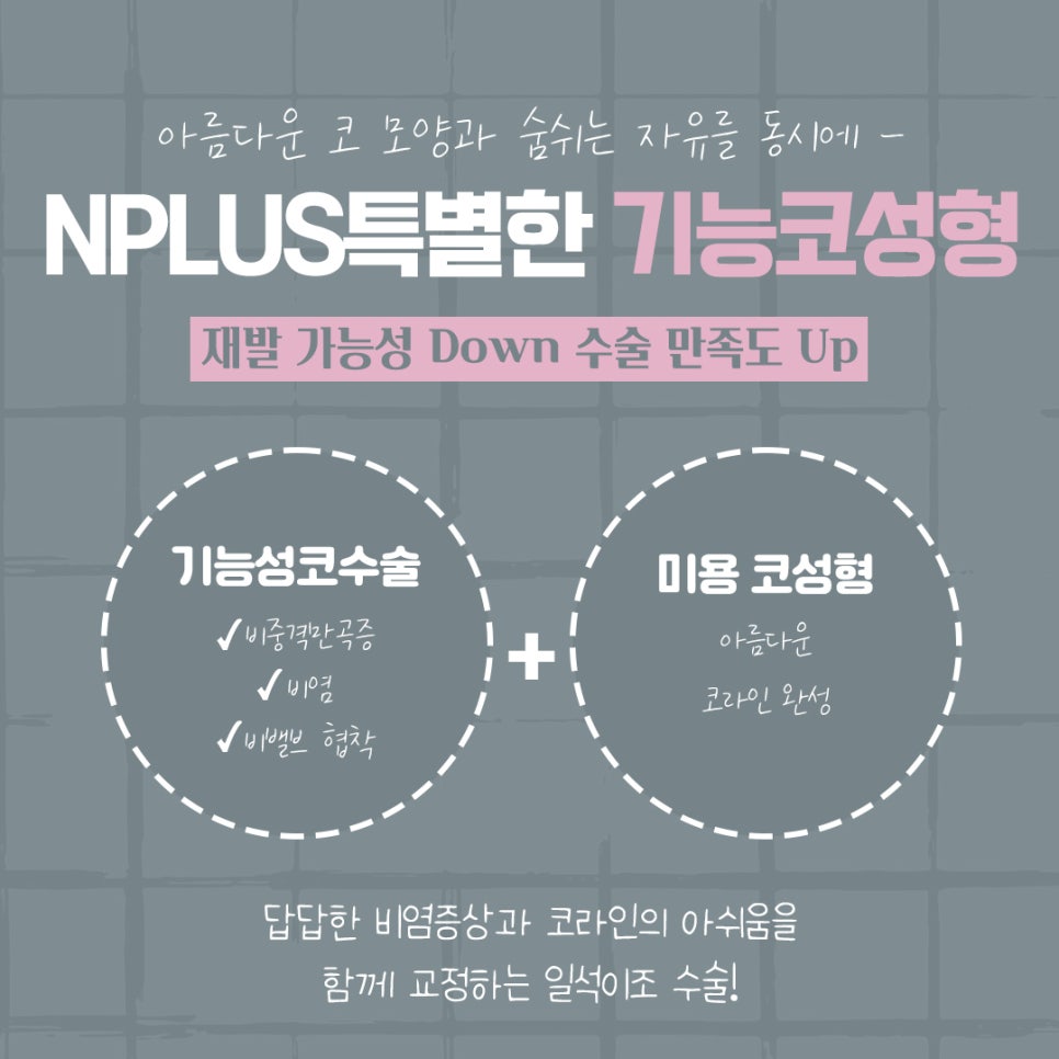 코성형후기 자연스럽고 예쁘게 관련 이미지 7
