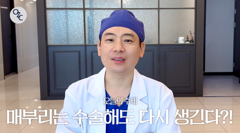 코성형 후에도 매부리재발이 될 수 있나요? 관련 이미지 2