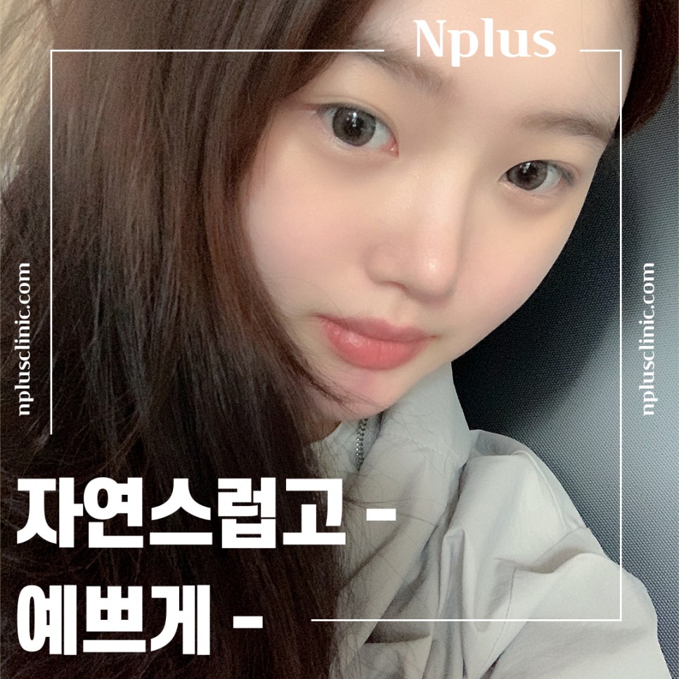 복코수술전후 확실한 차이를 알아보고 관련 이미지 6