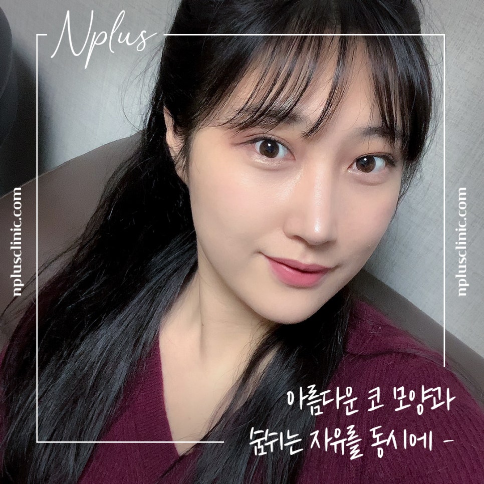 A Satisfying Result with One Rhinoplasty and Rhinitis Surgery image 3