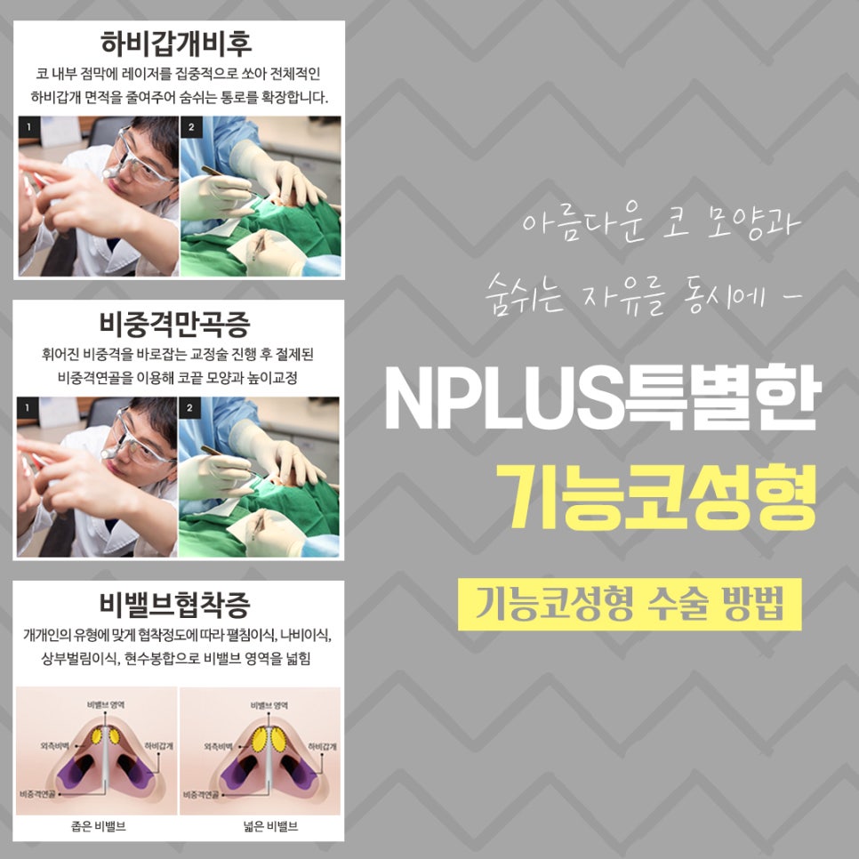 기능코성형을 통한 한쪽 코막힘 개선 관련 이미지 9