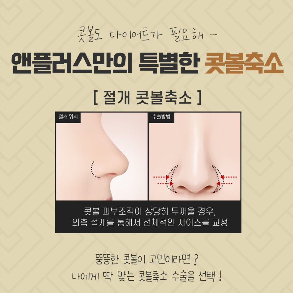 Nasal Ala Reduction Review: Research Carefully Before Deciding image 10