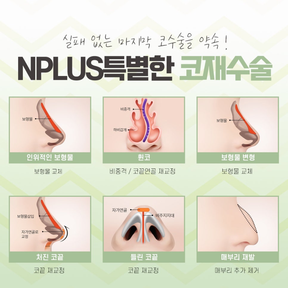 Looking at the Differences in Revision Rhinoplasty Reviews image 8