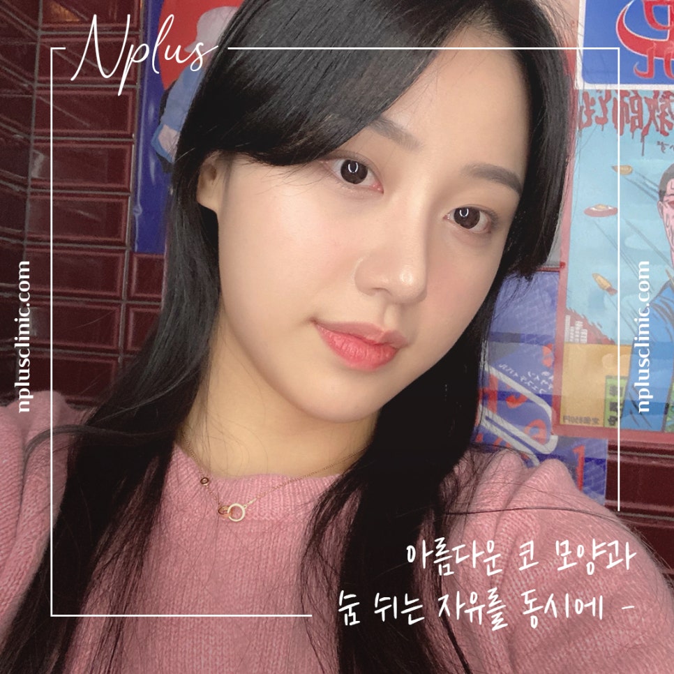늑연골코수술을 통해 세련된 라인으로 관련 이미지 2